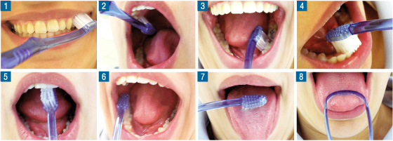 limpieza dental o higiene bucal